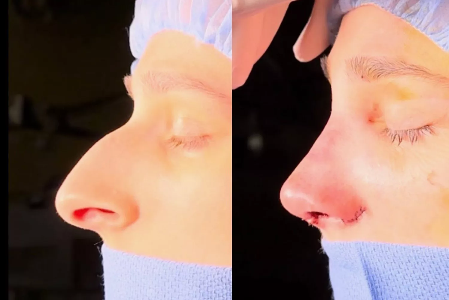 جراحة تجميل بـ11 ألف دولار ساعدت امرأة على إنهاء زواجها.. كيف؟