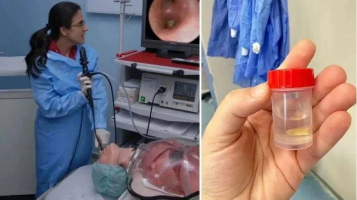 سيدة كادت تفقد حياتها بسبب وجبة أكلتها قبل 5 أشهر!
