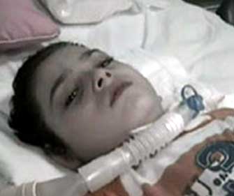 تركيب جهاز لطفل مشلول يعيد له التنفس الطبيعي بمستشفى الملك المؤسس