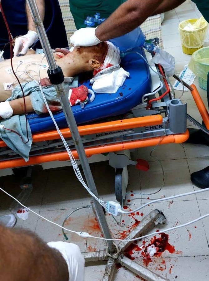 شهيد واصابة برصاص الاحتلال في المزرعة الغربية