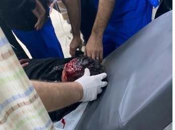 إصابة فتى برصاص الاحتلال بالرأس خلال مواجهات في اريحا