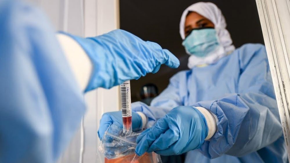 إصابات كورونا ترتفع منذ بداية العام.. 11.2% إيجابية الفحوصات الأسبوع الماضي