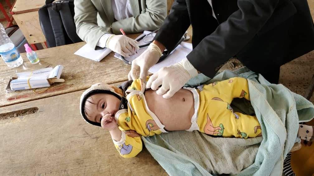 الحصبة تفتك بأطفال اليمن: وفاة أكثر من 400 طفل